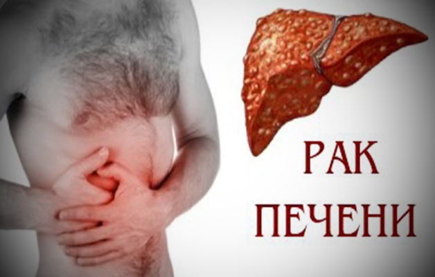 рак печени