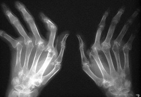 Рентген кисти