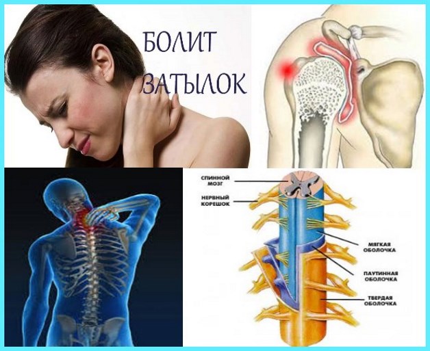 симптомы сдавливания нервов