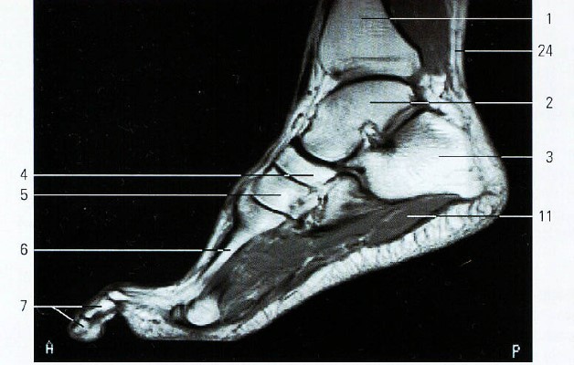 Сводчатое строение стопы