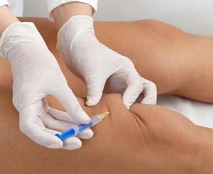 Укол в колено