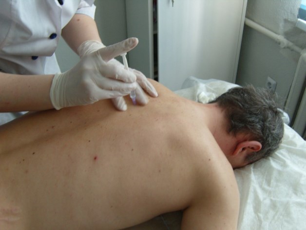 уколы при шейном остеохондрозе