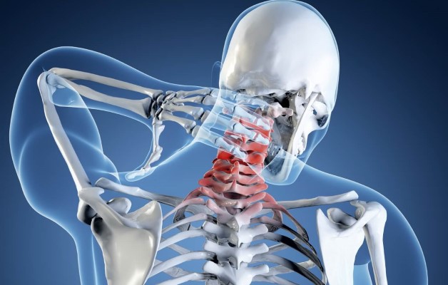 унковерьебральный артроз