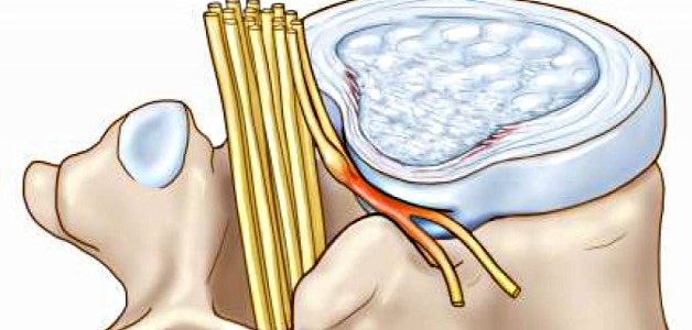 изменение нерва